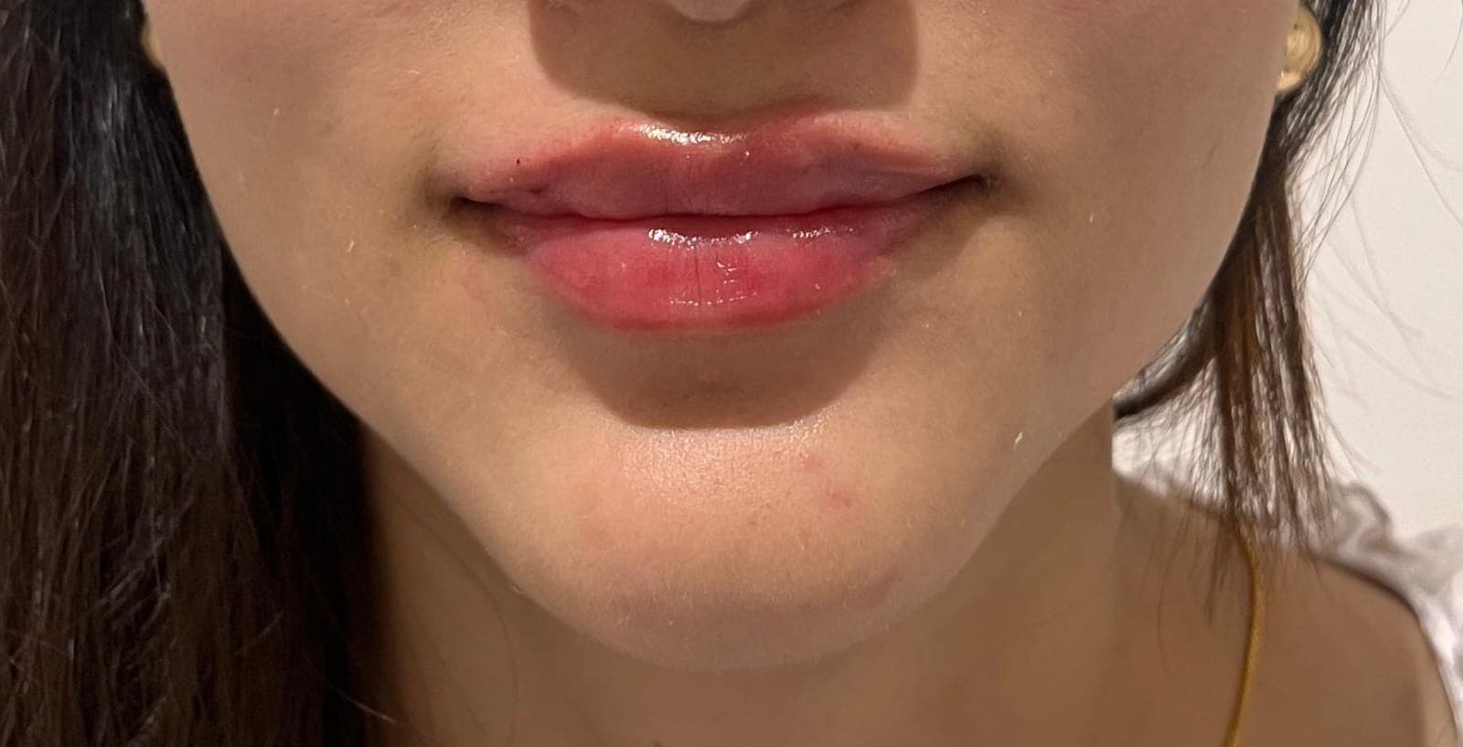 After treatment