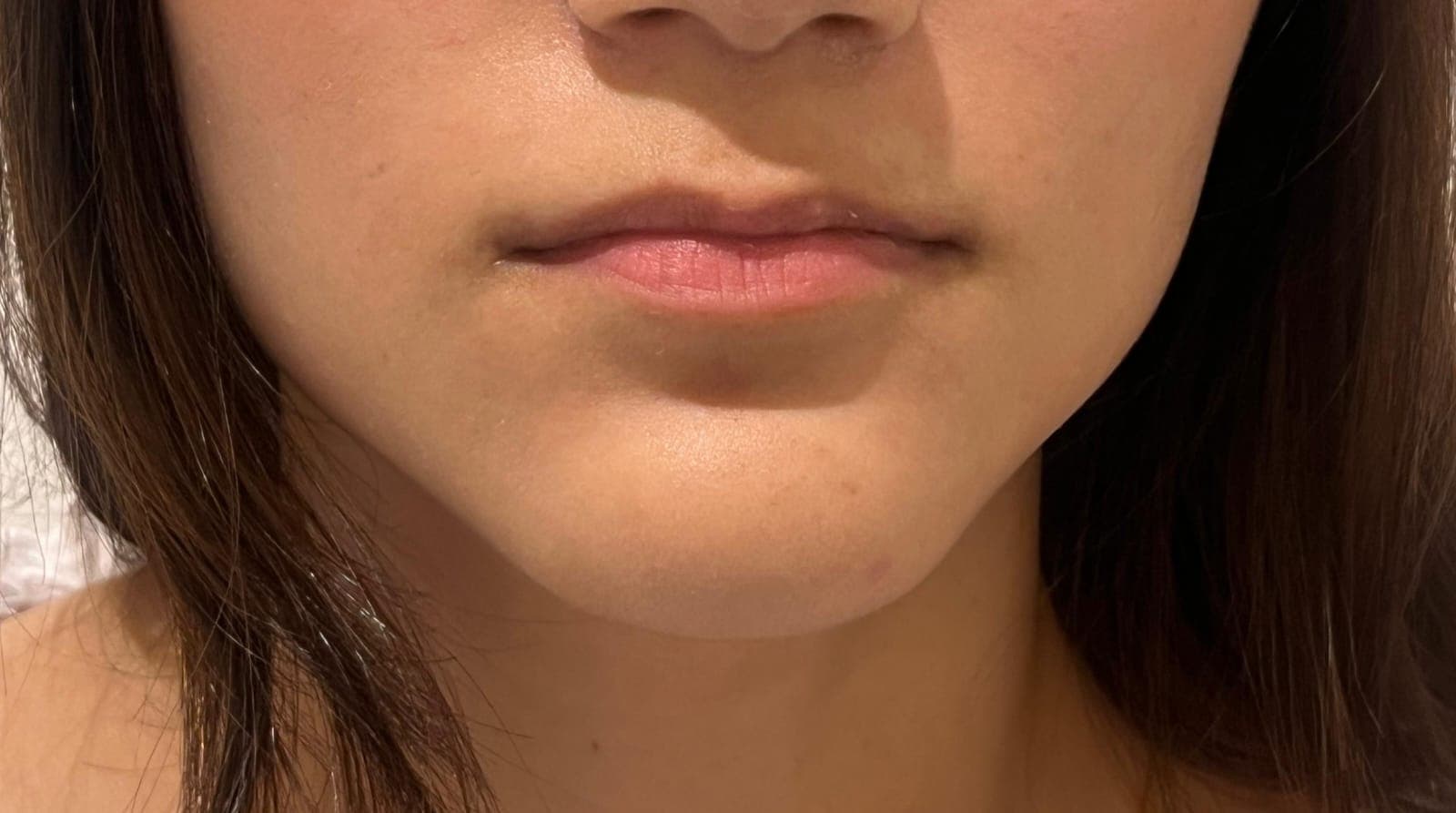 Before treatment